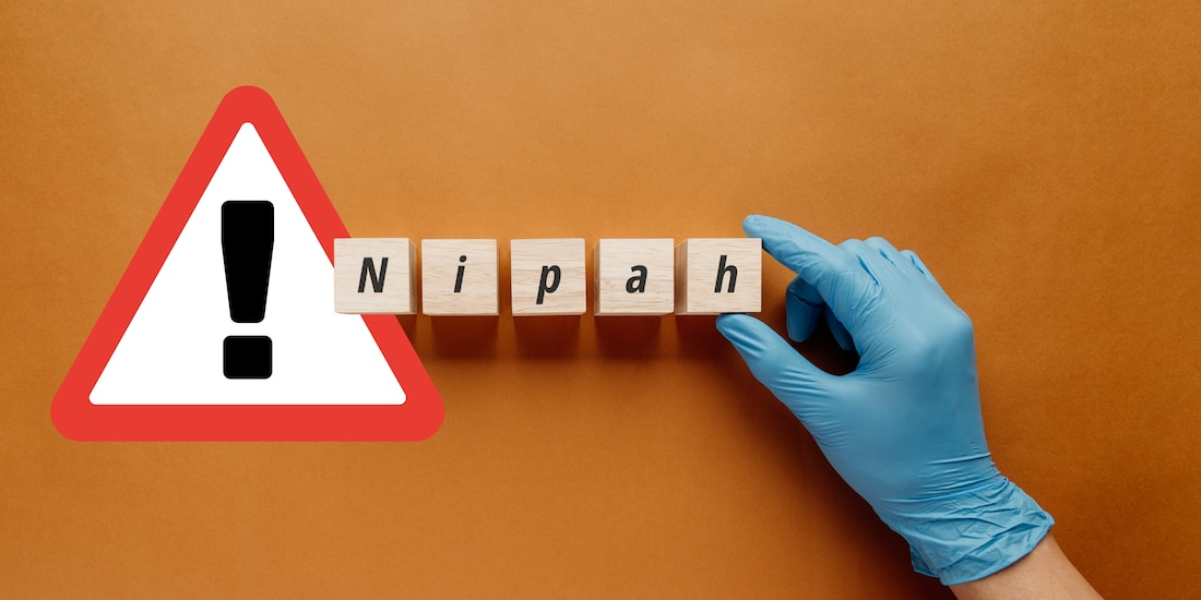 ¿Qué es el virus Nipah y cómo se transmite en humanos?