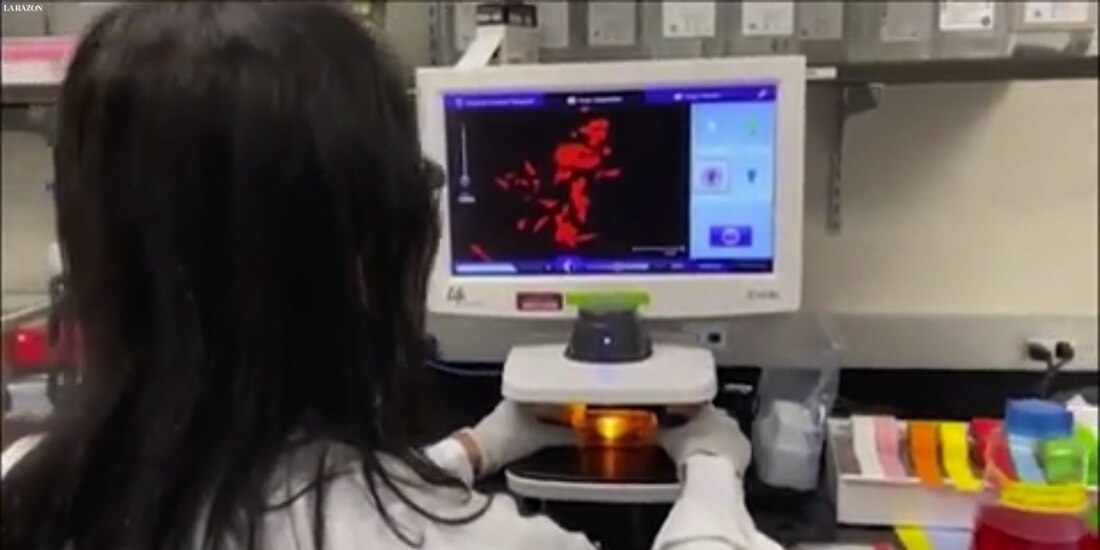 Instan a aislar y rastrear casos de viruela símica