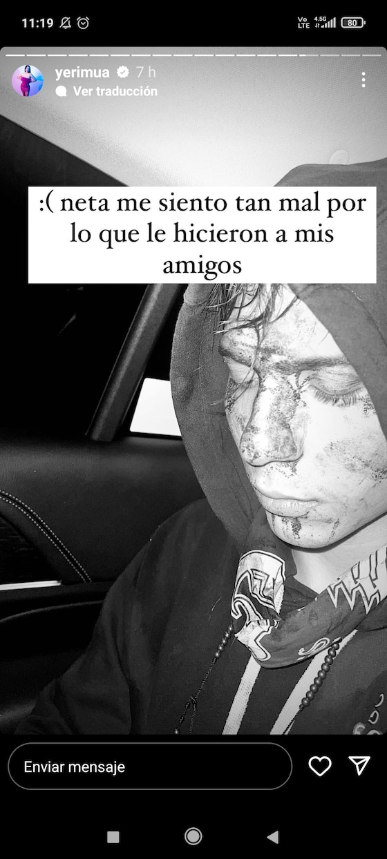 Yeri Mua exhibe agresión de su exnovio