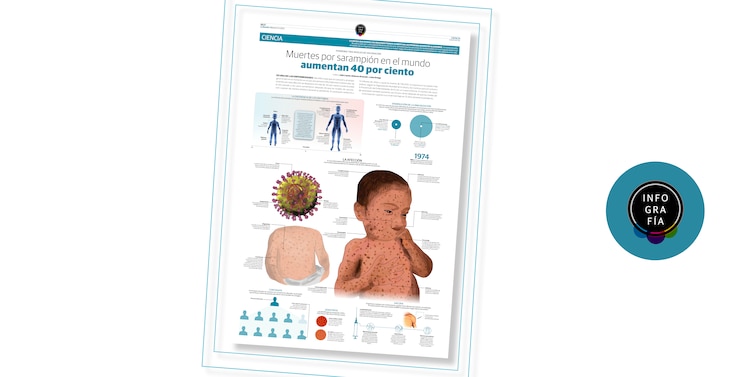 Muertes por sarampión en el mundo aumentan 40 por ciento
