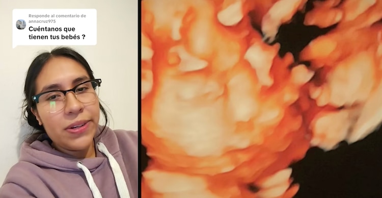 Historia de los bebés con oxígeno