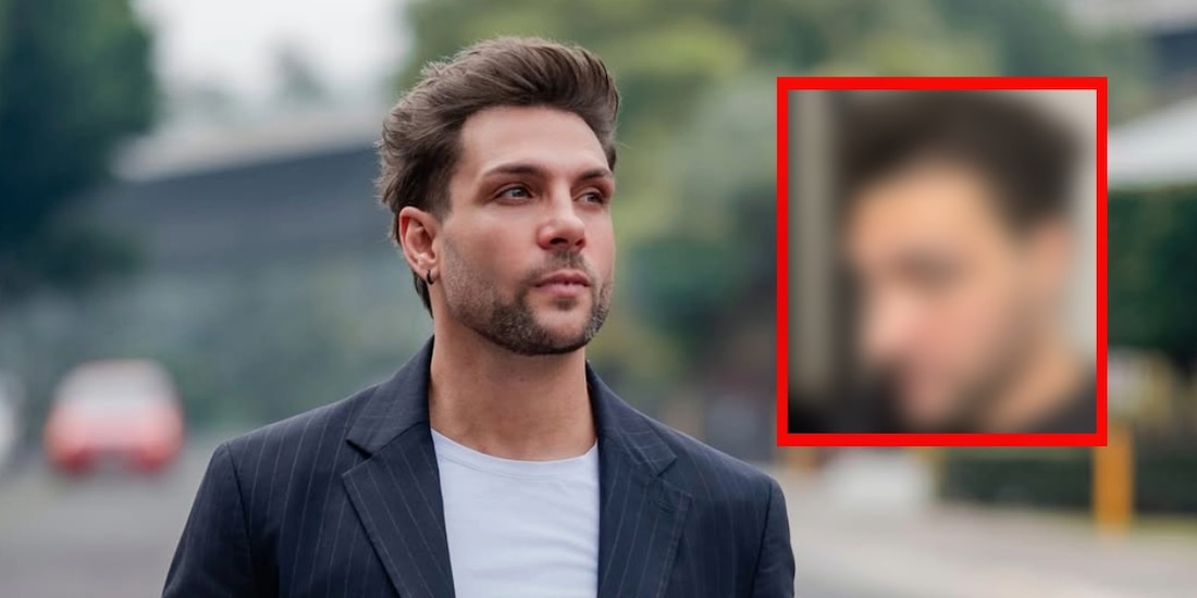 Nicola Porcella muestra su nueva nariz tras operación