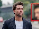 Nicola Porcella muestra su nueva nariz tras operación