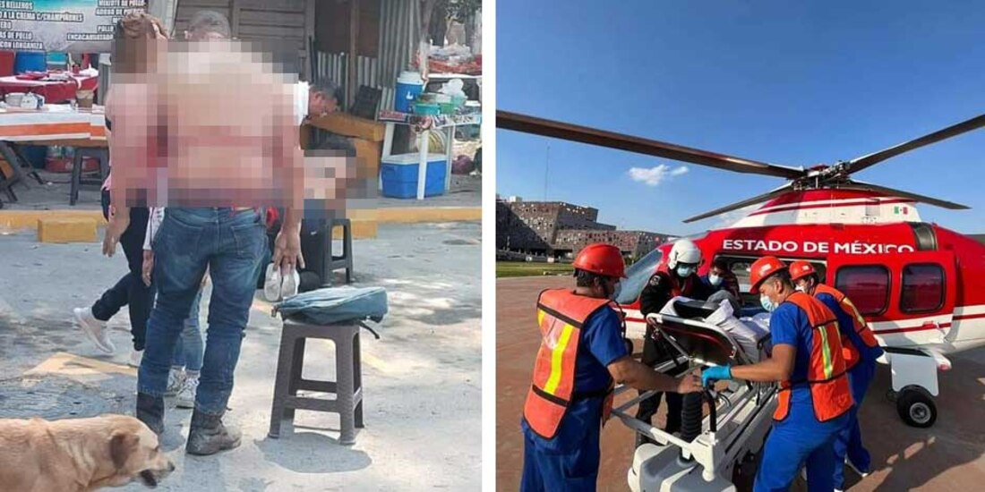 Un tanque de gas explotó en un tianguis de Huehuetoca, Edomex, y dejó al menos 29 heridos
