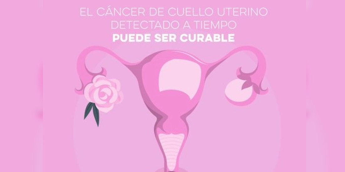 Detección oportuna de VPHDetección oportuna de VPH previene el cáncer cervicouterino