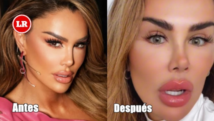 El antes y después de Ninel Conde, tras cambio de color de ojos