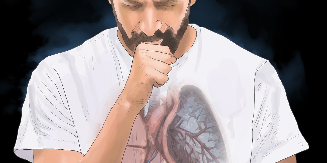 Lluvias ayudan al alza de casos de neumonía.