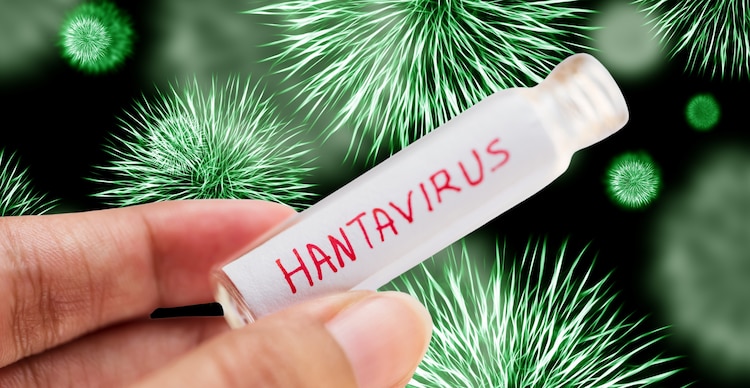 Hantavirus