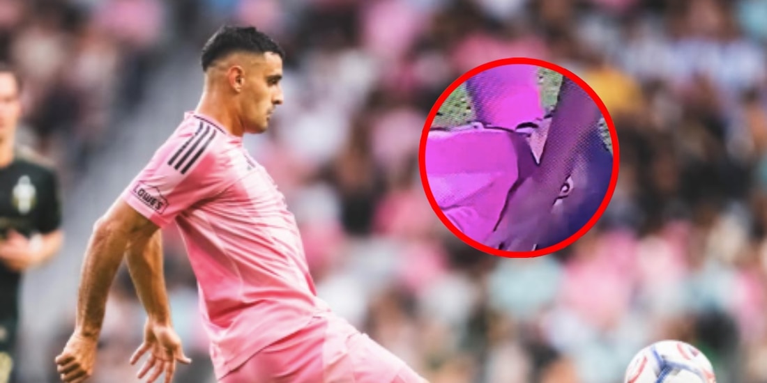 Germán Berterame sufrió un brutal golpe de cabeza en juego de Inter Miami en la MLS.