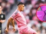 Germán Berterame sufrió un brutal golpe de cabeza en juego de Inter Miami en la MLS.