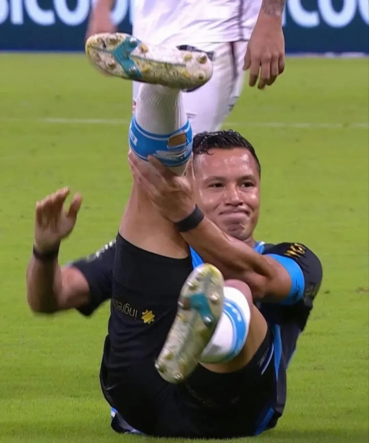 Marlon sufre fractura de tobillo.