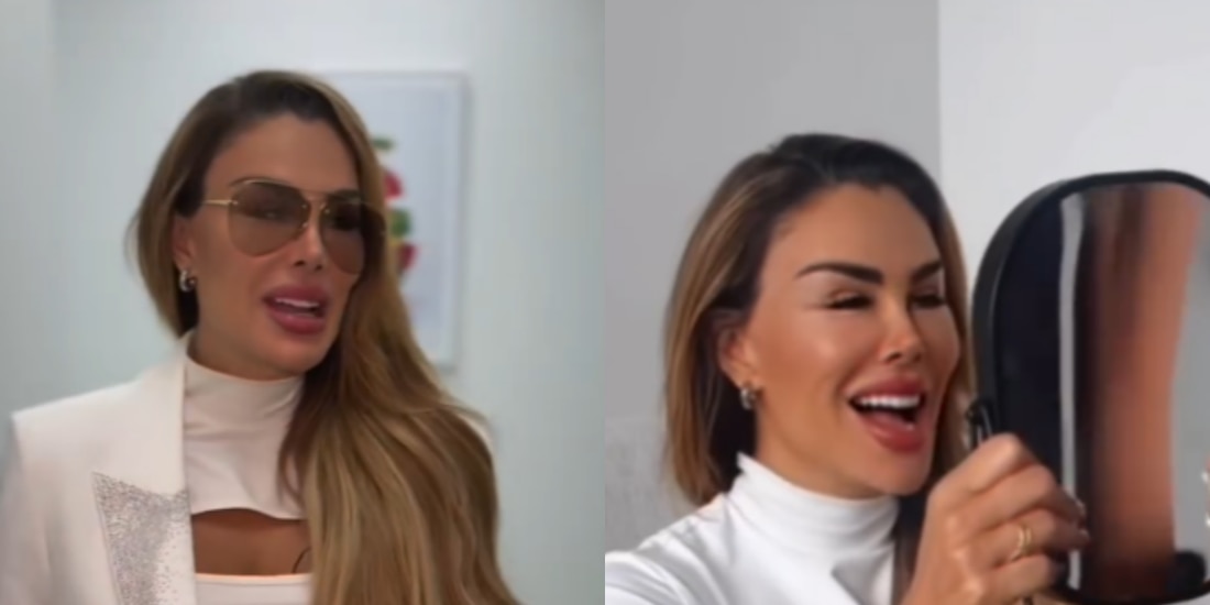 Ninel Conde cambia de color de ojos con operación; ¿cuánto cuesta y de qué se trata?