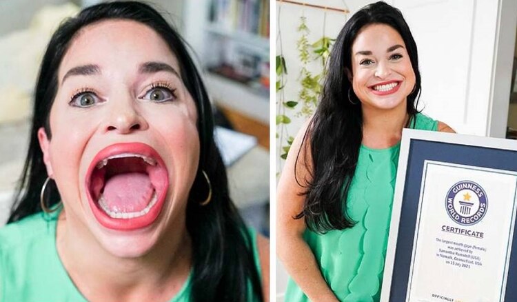 Tiene muchos seguidores en TikTok que tienen curiosidad por su boca