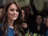 ¿Cuáles son las cirugias que ha tenido Kate Middleton a lo largo de su vida?