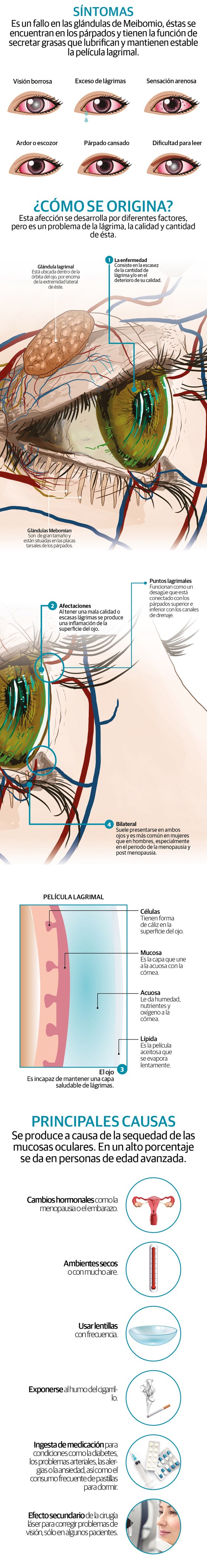 ¿Síndrome del ojo seco? Lo padecen tres de cada 10 personas en el mundo