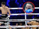Así le quedó el rostro a Luis Pantera Nery tras ser noqueado por Naoya Inoue