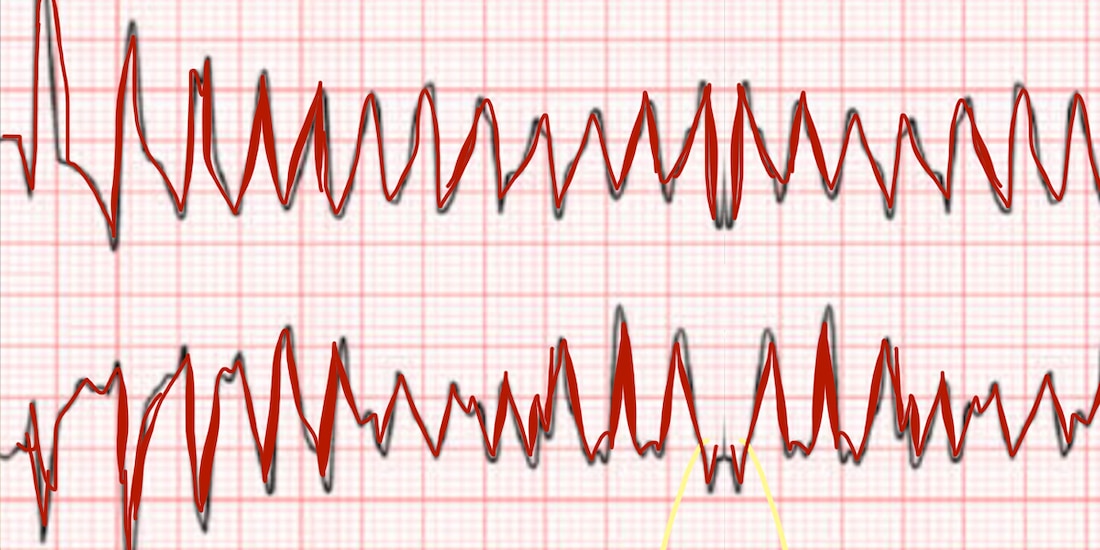 DE QUÉ HABLO CUANDO NO HABLO
