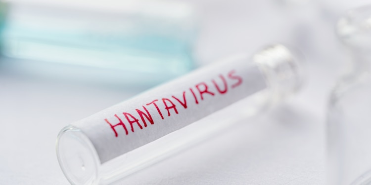 Hantavirus