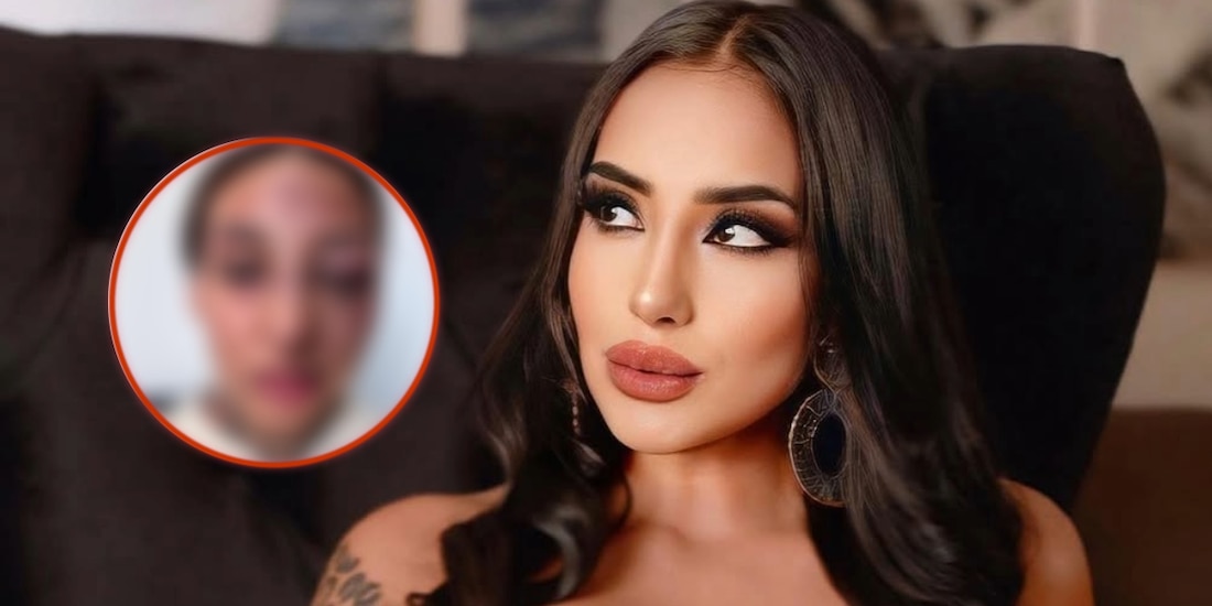Dulce de Paz, modelo de OnlyFans denuncia agresión de su pareja.
