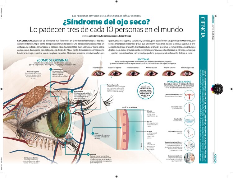 ¿Síndrome del ojo seco? Lo padecen tres de cada 10 personas en el mundo
