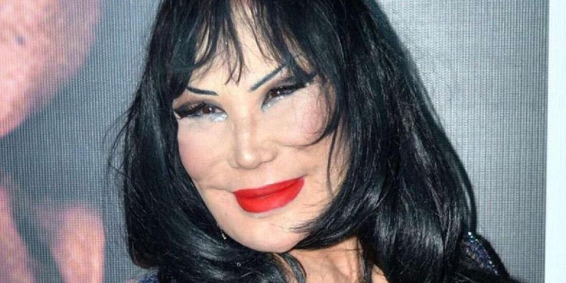 Lyn May sorprende con su cambio en el rostro