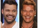 Ricky Martin rompe el silencio y revela la razón de su cara "operada"