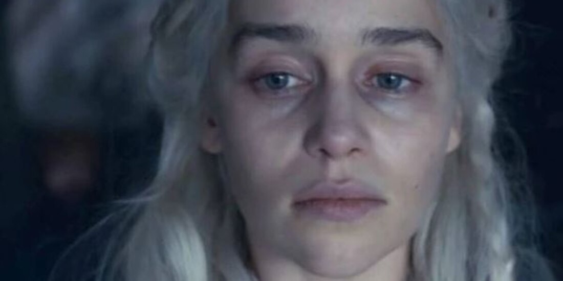 Emilia Clarke confiesa que no le sirven partes del cerebro por aneurismas