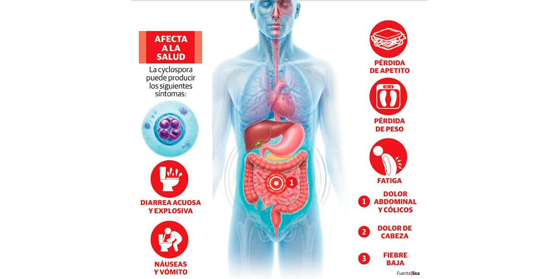 La cyclospora puede producir los siguientes síntomas:
