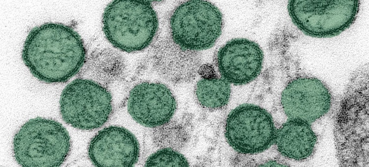 El hantavirus puede contagiarse por contacto cercano y prolongado de persona a persona