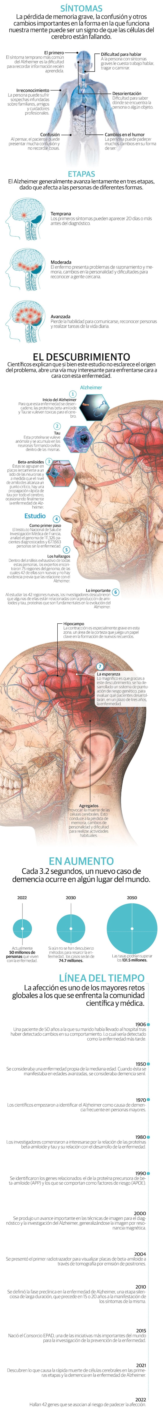 Identifican 42 genes asociados al riesgo de tener la enfermedad de Alzheimer