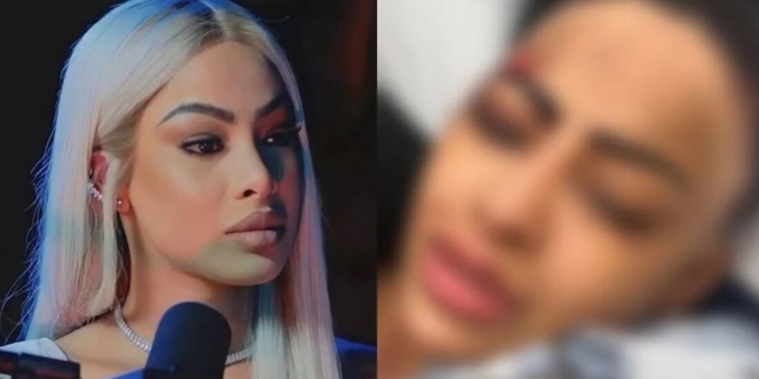 Yailin la más viral se muestra con la cara llena de golpes ¿le pegaron?