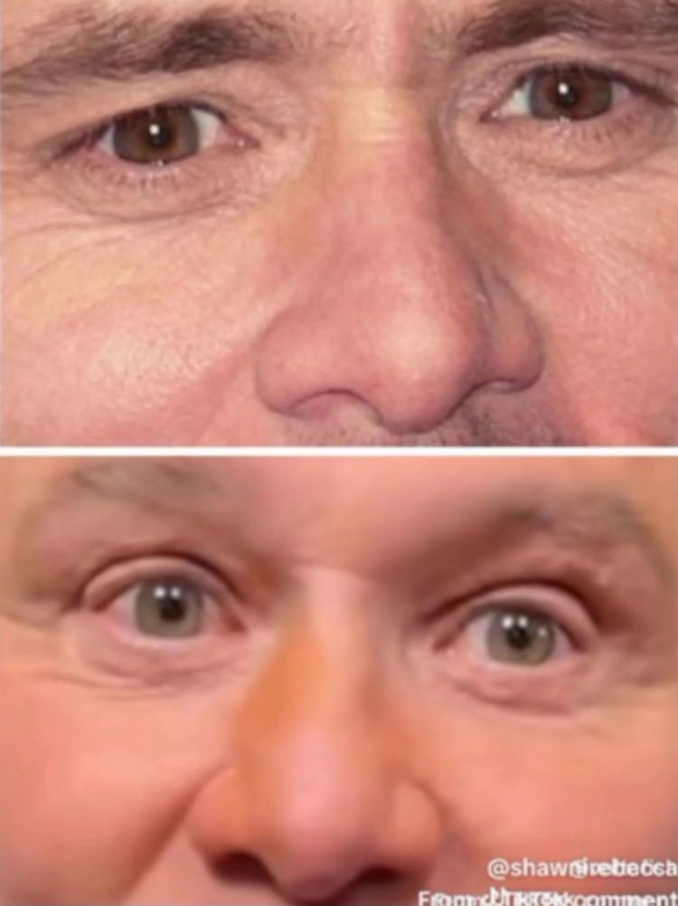 Color de ojos de Jim Carrey, antes y después