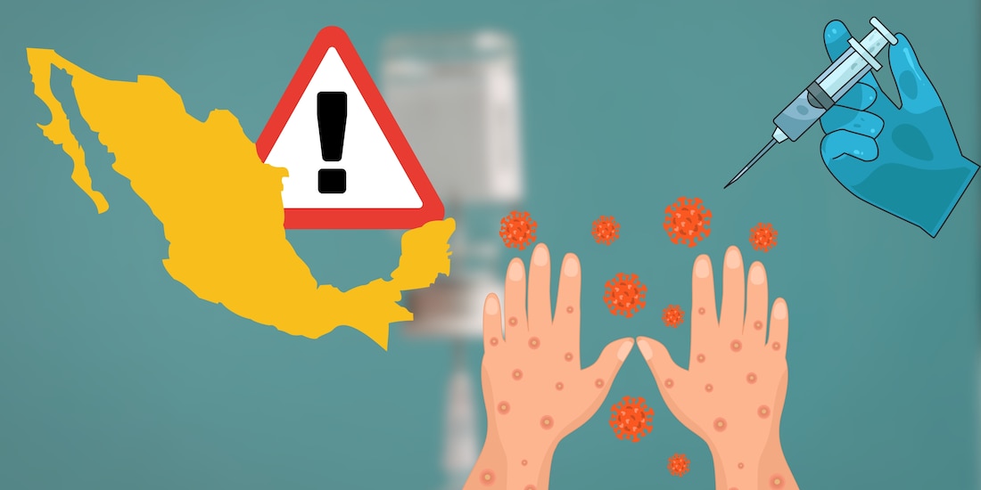 Alerta por sarampión en México