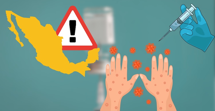 Alerta por sarampión en México