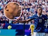 ¿Qué se ha hecho Mbappé en la cara?
