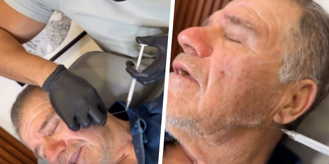 Reaparece "Cuco" Rovirosa aplicándose botox.