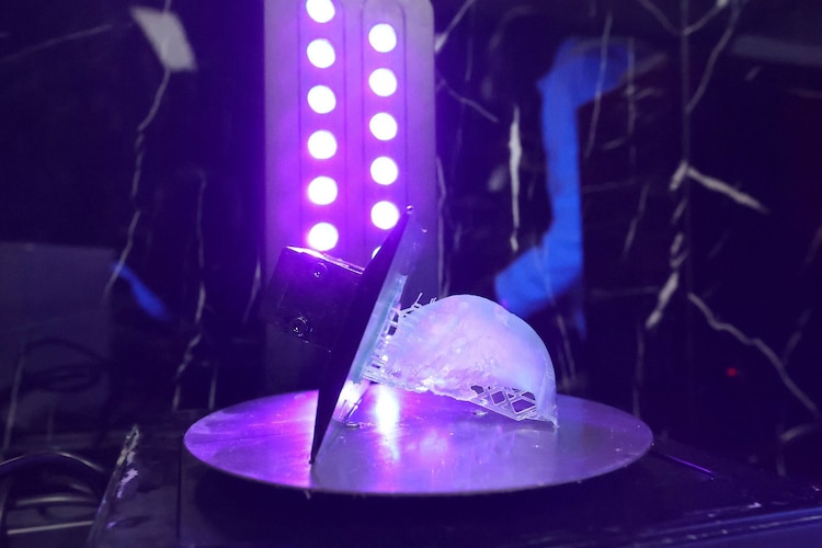 La innovadora tecnología del IPN podría mejorar la detección temprana y planificación quirúrgica del cáncer de mama.