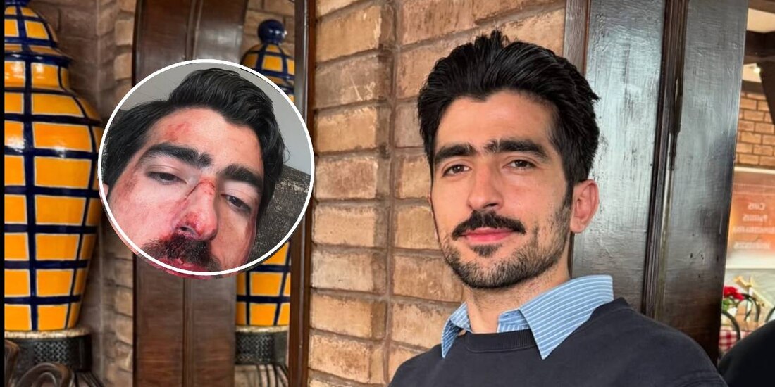 Esto fue lo que realmente le pasó a Jezzini