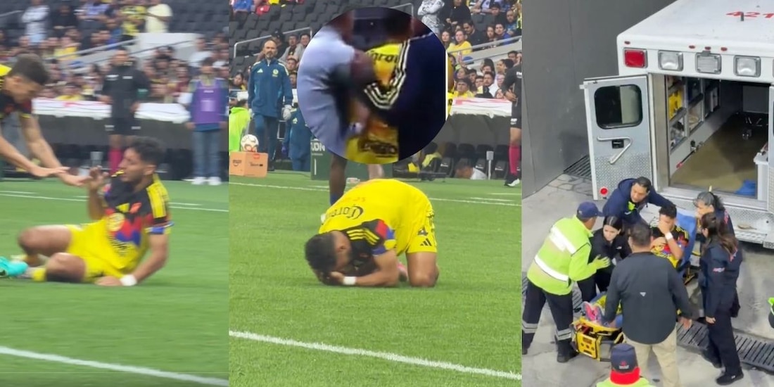 Sebastián Cáceres salió lesionado por una conmoción cerebral en el duelo de América vs Pumas.