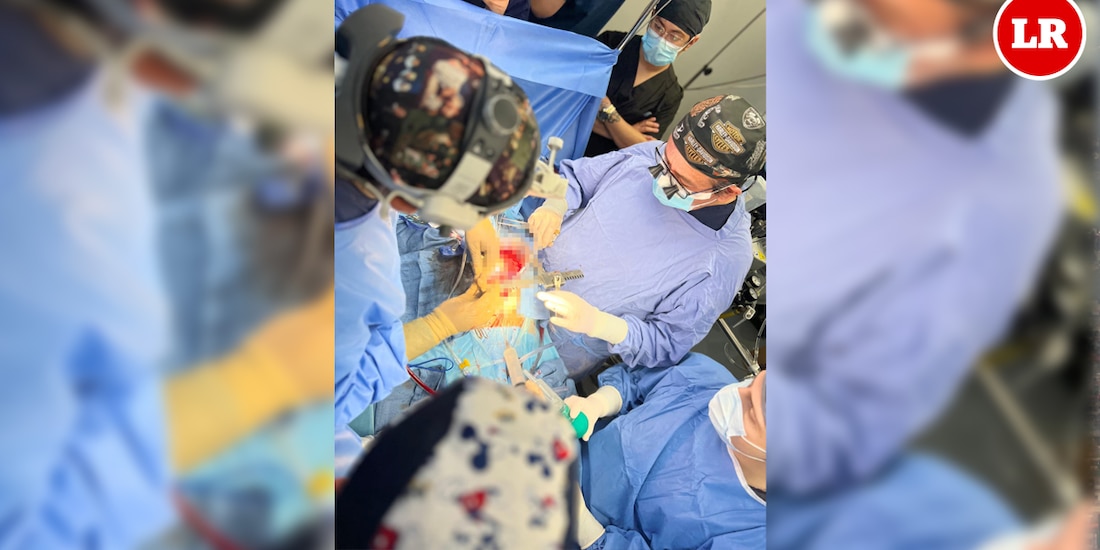 ISSSTE realiza con éxito cirugía a corazón abierto.