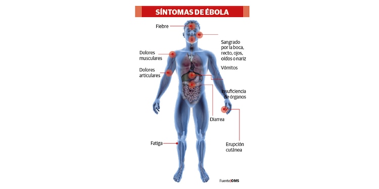 SÍNTOMAS DE ÉBOLA
