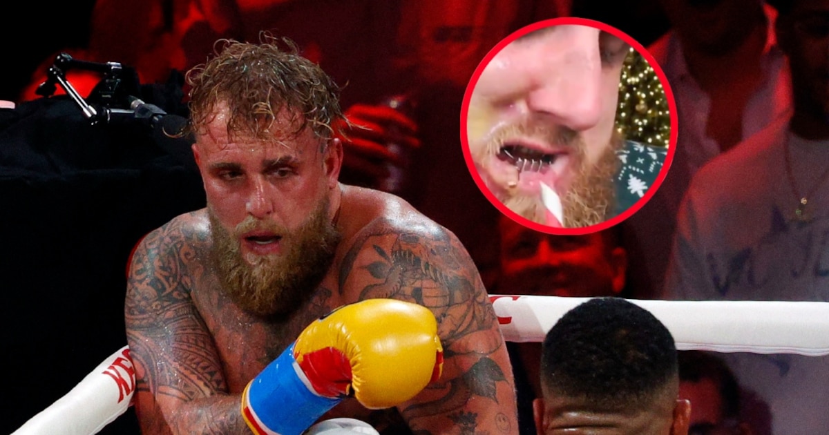 ¡IRRECONOCIBLE! Así le quedó la cara a Jake Paul luego de que Anthony ...