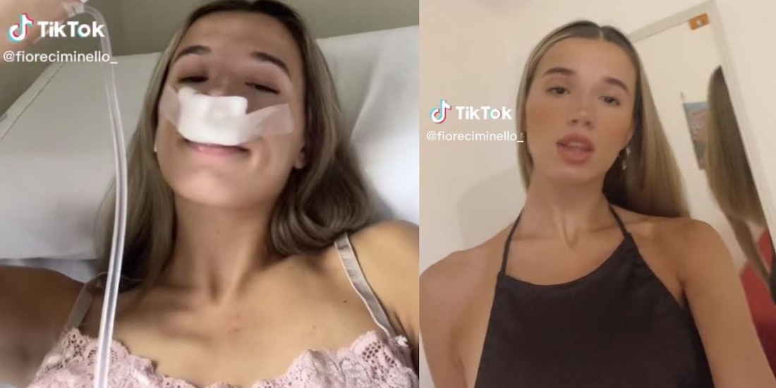 Tiktoker se opera la nariz para que sus hijos nazcan con una linda