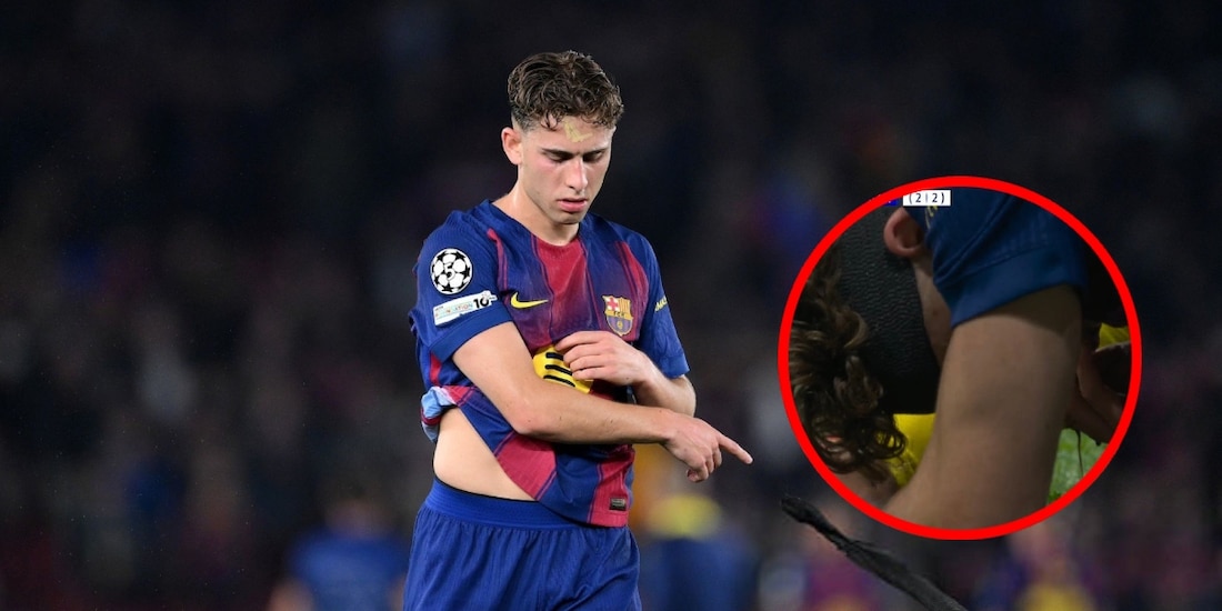 Terrible golpe a Fermín López en la Champions le destroza la cara