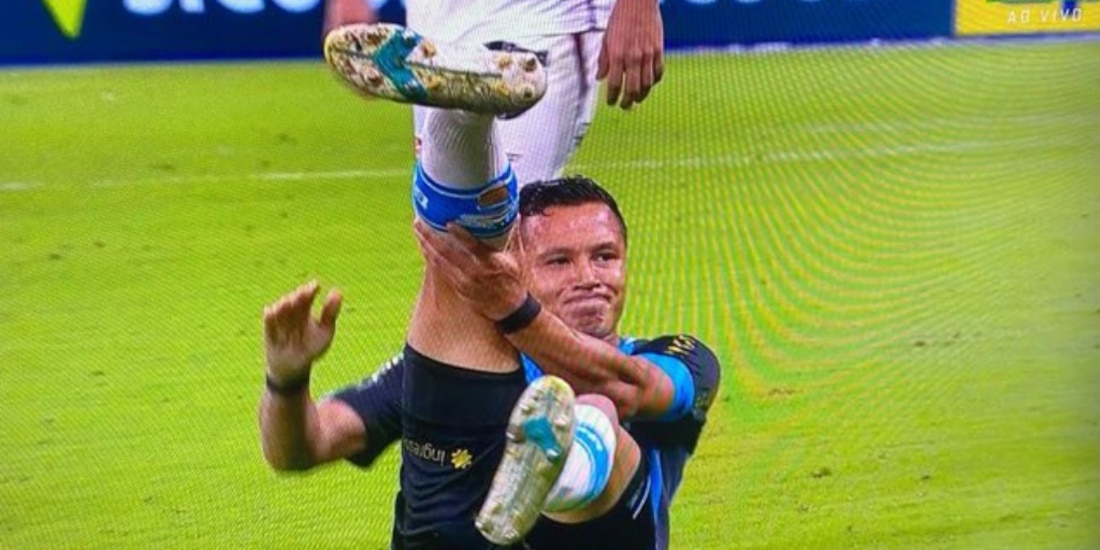 Jugador brasileño se rompe el pie.