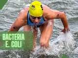 La bacteria E. Coli habría infectado a la atleta belga Claire Michel.