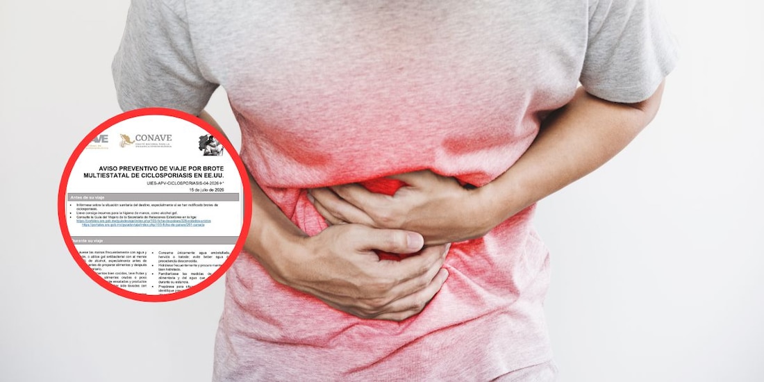 Brote de ciclosporiasis en EU