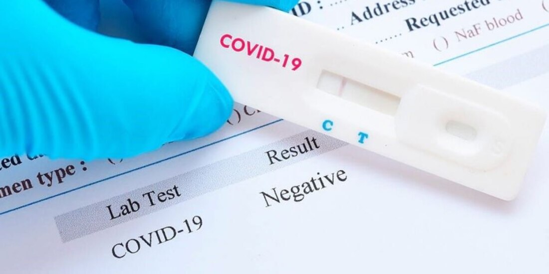 Pruebas serológicas pueden detectar anticuerpos a la enfermedad