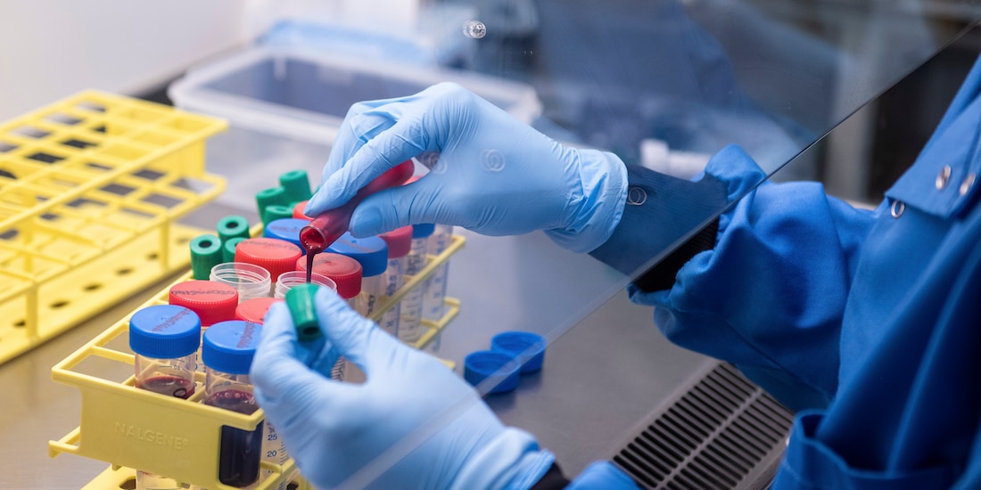 Muestras de sangre de un ensayo para una vacuna del coronavirus, en el Instituto Jenner, en Oxford, Inglaterra, el 25 de junio de 2020.