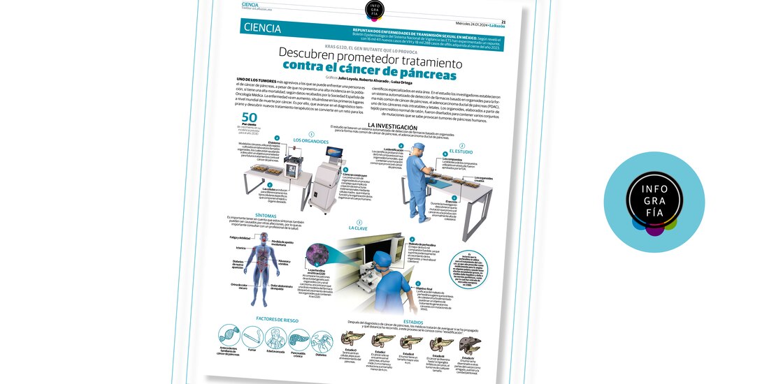 Cáncer de páncreas